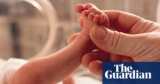 Microplastics in placentas linked to untimely births, examine suggests | Plastics