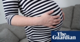 Three-quarters of UK fertility sufferers utilizing unproven add-on therapies | Fertility issues